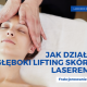 lifting skóry laserem